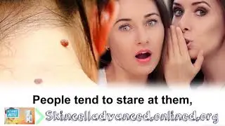 Skincell Advanced - Skincell Advanced Review
