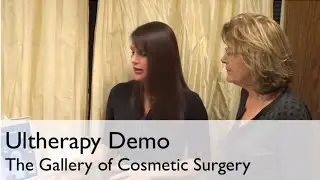 Brow lift, Forehead Lift, Under-Chin Lift, Neck Lift and D&eacute;collet&eacute; tightening - Ultherapy Demo