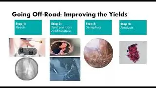Empowered Imaging Solutions for Bronchoscopic Interventions