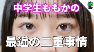 【整形疑惑？】最近調子が良い私の二重事情をお伝えします【アイプチ講座】