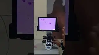 DNA Fragmentation Index & Halo Test Explained | Dr. Pankaj Talwar