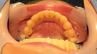 GC Ortho connect flow