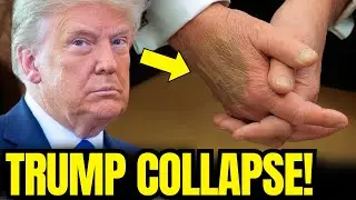 From Epstein Files to Bruised Hands: Trump&rsquo;s Second Term Is Total Disaster