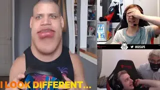 TYLER1 NEW HEADSHAPE  