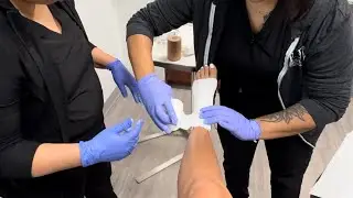 How to apply an Unna Boot - used for edema and wound care.
