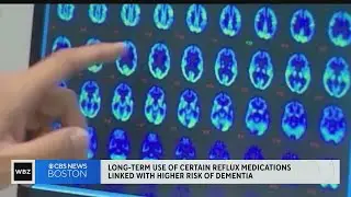 Long-term use of certain antacids may be associated with dementia, study says