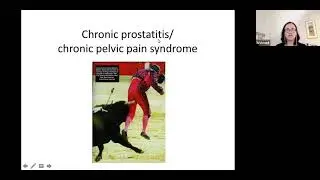 IVUmed VVP: Interstitial Cystitis and Chronic Pelvic Pain Syndrome