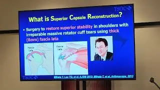 SCR : Graft Developments Future Xenograft Prof.Hiro Sugaya 1st ISCRA Meeting Sonoma California USA