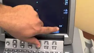 Obtaining Views in Ultrasound:  Gain and Depth