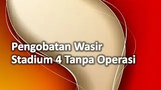 Pengobatan Wasir Stadium 4 Tanpa Operasi