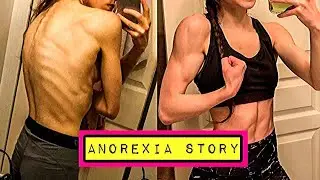 My Anorexia Story (in pictures) | Sickness to Fitness