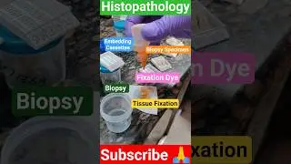 Histopathology fixation ✓ Biopsy Fixation Grossing #histopathology #lab #shortvideo