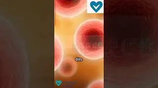 Broken Heart Syndrome (Takotsubo Cardiomyopathy) - How stress can literally break your heart ❤️