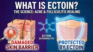 What is Ectoin? The Science Behind Healing Acne & Folliculitis