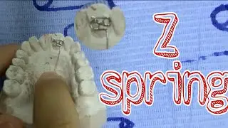 Orthodontic appliance || Wire  bending  Z  spring