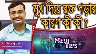 What Causes Bleeding from the Mouth ? || Dr. Debraj Jash || Consultant Pulmonologist
