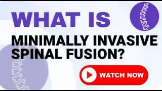 What is Minimally Invasive Spinal Fusion?