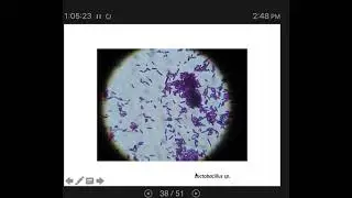 Microbial Growth 5: Environmental Limits- pH