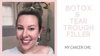 Botox & Tear Trough Filler: My Skin Raleigh Experience