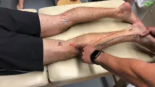 Approche thérapeutique manuelle des tissus mous de la jambe