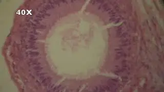 MICROSCOPIC VIEW - EPIDIDYMIS