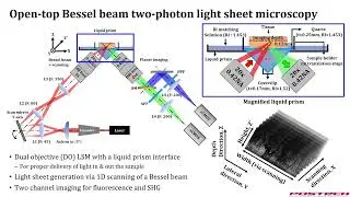 Open-top Bessel beam two-photon light sheet microscopy for 3D pathology