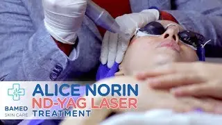 Alice Norin meet ND-YAG Laser | Bamed Skin Care