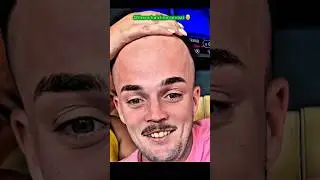 Others hairlines vs THIS ONE GUY💀