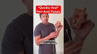 How To Heal A Peri Anal Fistula FAST