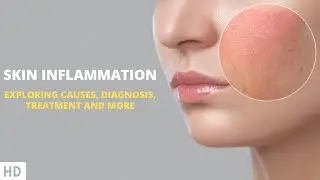 Empowering Your Skin: Navigating the Challenges of Inflammation