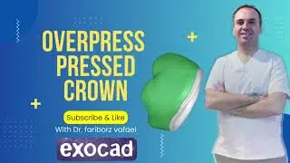 overpress  pressed crown