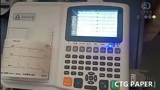 ECG Paper Sizing: 3&times;4 vs. 5&times;8&mdash;Which Is Better for Your Machine?