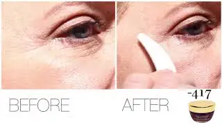 Minus 417 - Miracle immediate wrinkle filler