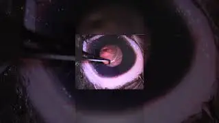 Deep Corneal Ulcer #shorts #veterinaryophthalmology