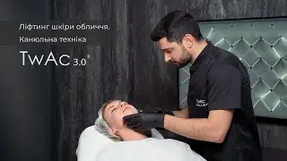 Роман Школьний - Ліфтинг шкіри обличчя препаратом TwAc 3.0. Канюльна техніка
