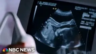 Concerns for pregnant women as CDC warns of rise in parvovirus