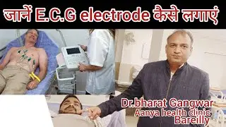 Learn how to place the ECG electrode.