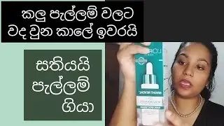 💐L'Oréal Niacinamide Bright Reveal - Sinhala Review සතියයි පැල්ලම් ගියා #niacinamideserum
