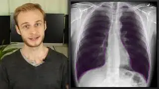 Chest X Rays CXR Made Easy!   Learn in 10 Minutes!480p