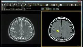 Neuro Imaging: Board and Recredentialing Review 4
