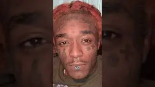 What happened to Lil Uzi Vert&rsquo;s $24 million diamond on his forehead #dogearmy #dogeelon