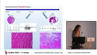 CRY Conference 2017 - ARVC; Novel treatment options - Dr Angeliki Asimaki