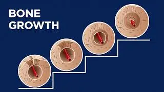 Bone Growth
