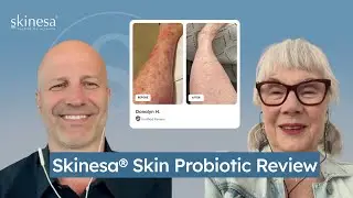 Skinesa&reg; Customer Interview | Donalyn&rsquo;s Experience