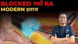 Blocked Leg Arteries Ka Non-Surgical Treatment | Dr Anadi Gupta Explains