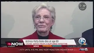 Actress Patty Duke dies