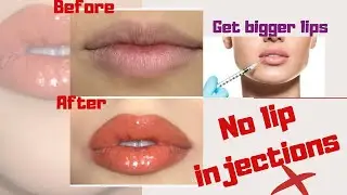 How to get fuller lips without lip injections!