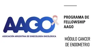 Anatomía patológica - Cancer de endometrio por dra Ailin Ceppeda