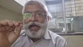 TURNAROUND CASE - SHARE INVESTMENT / तोट्यातून नफ्याकडे वाटचाल करणारा समभाग शोधणे