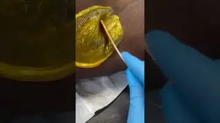 Депиляция подмышек твердым воском Sexy Smooth Golden Allure от @aromaallurebeauty | Бережное удал...